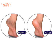 Chà gót chân Vacosi